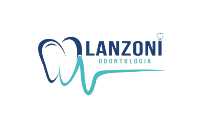 lanzoni